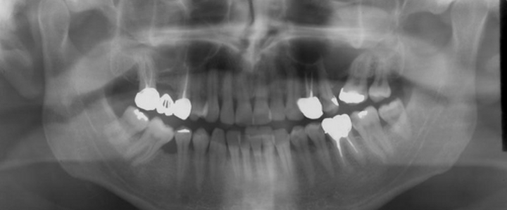 Dentista Milano Le radiografie fanno male?