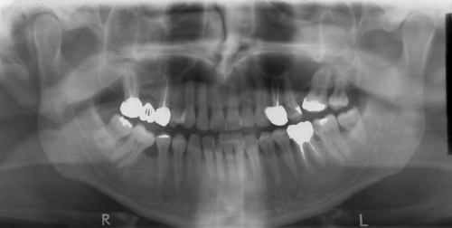 fare radiografia denti Milano